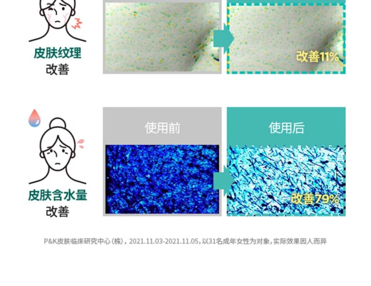 South Korea aestura Aisite Lan Daily Moisturizing Soothing Centella Asiatica Cotton Pads Nourishing Redness Improvement60Piece