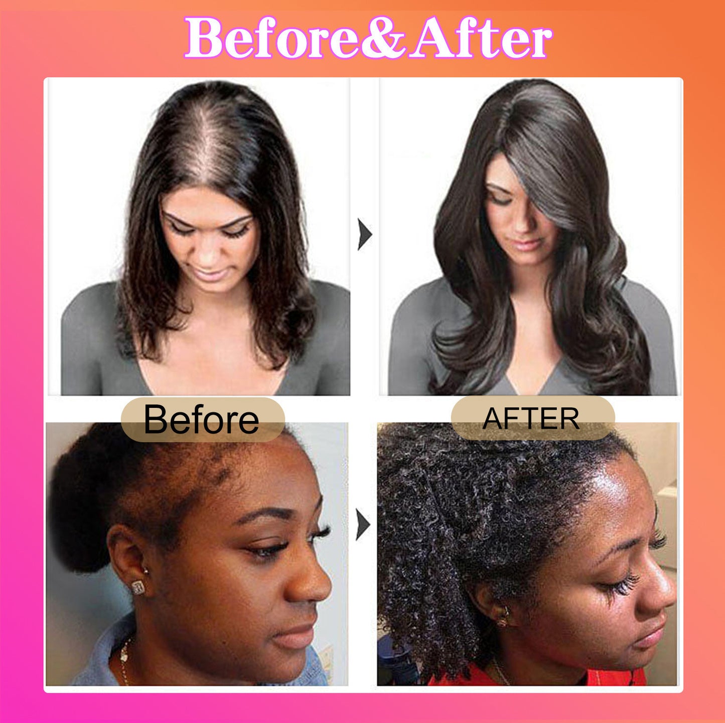 Batana Oil for Hair Growth Batahana Oil Conditioner Moisturizing Repair Strengthening Anti-Hair Loss Dense Hair